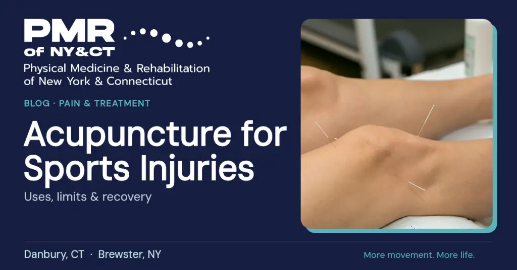 Acupuncture for Sports Injuries: What It Can and Can't Do