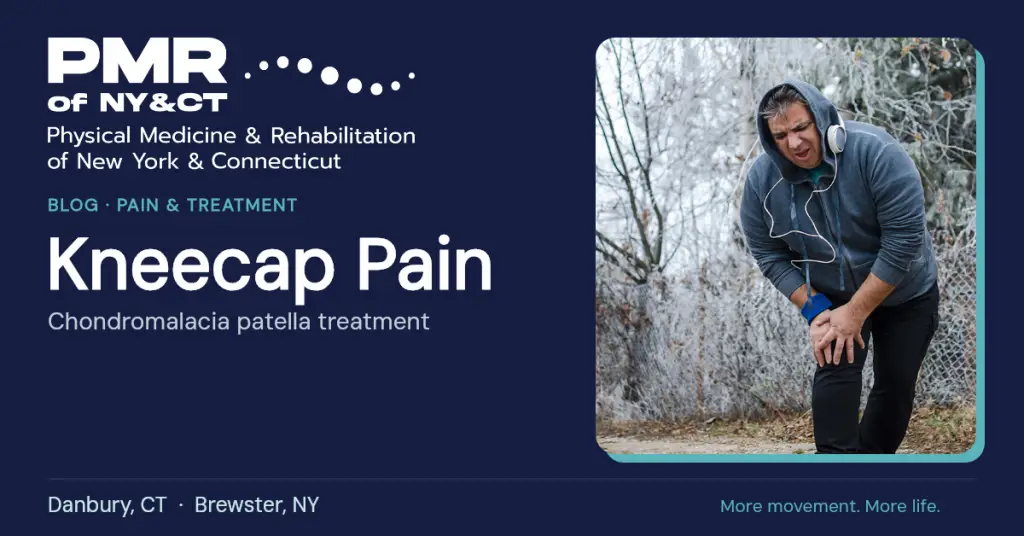 Chondromalacia Patella Treatment: Easing Pain Behind the Kneecap