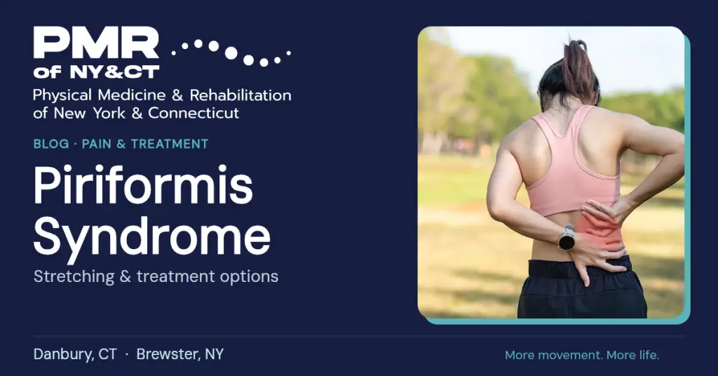 Piriformis Syndrome Treatment: From Stretching to Chiropractic Care