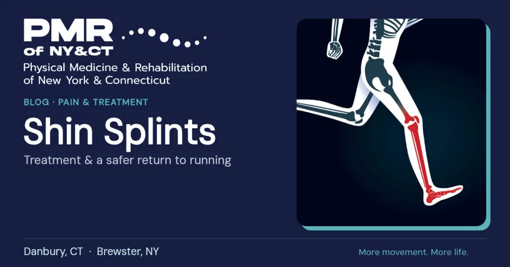How to Treat Shin Splints and Get Back to Running Safely