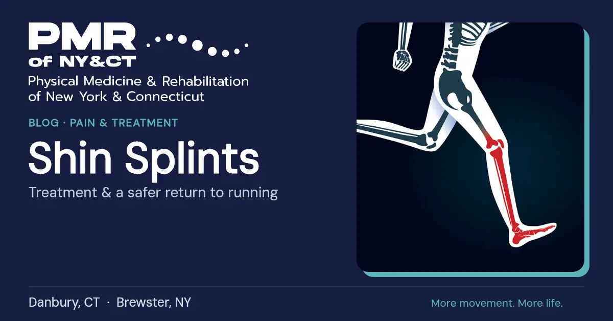 How to Treat Shin Splints and Get Back to Running Safely