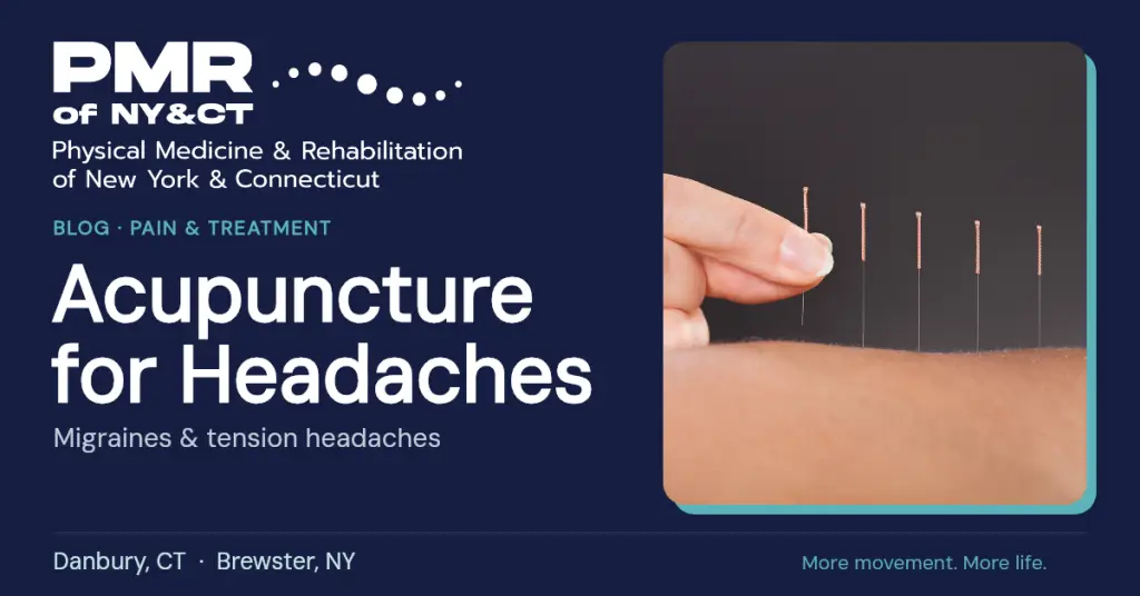 Acupuncture for Migraines and Tension Headaches: What Research Shows