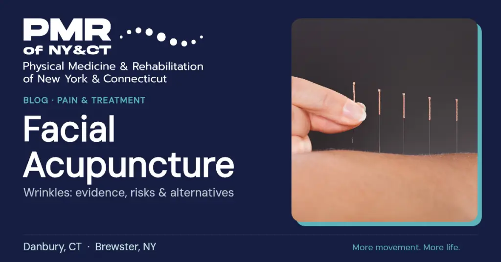 Facial Acupuncture for Wrinkles: Evidence, Risks and Alternatives
